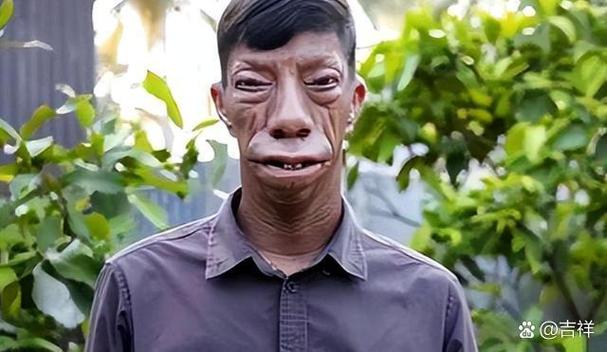 死鱼脸(死鱼脸是什么样子的)